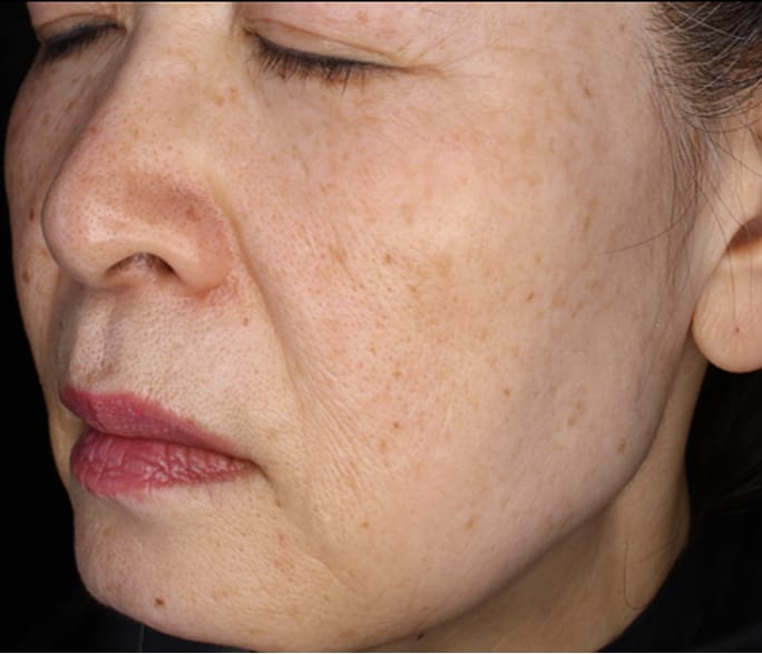 Case 02 After 1ヶ月半後