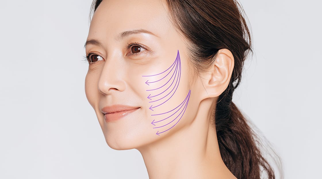 リフト方向の施術イメージ