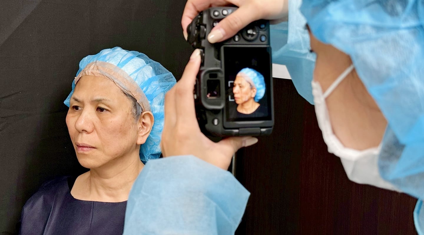 術後写真撮影のイメージ