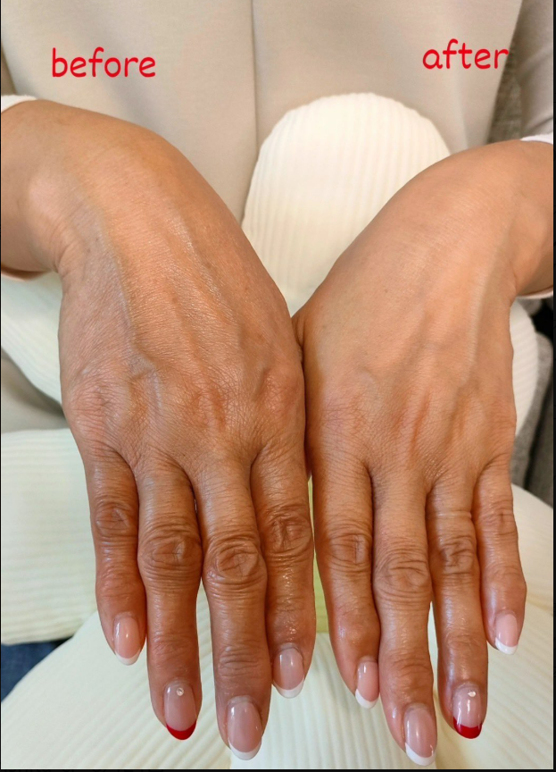 手と首は年齢を表す！ぬかりなく！