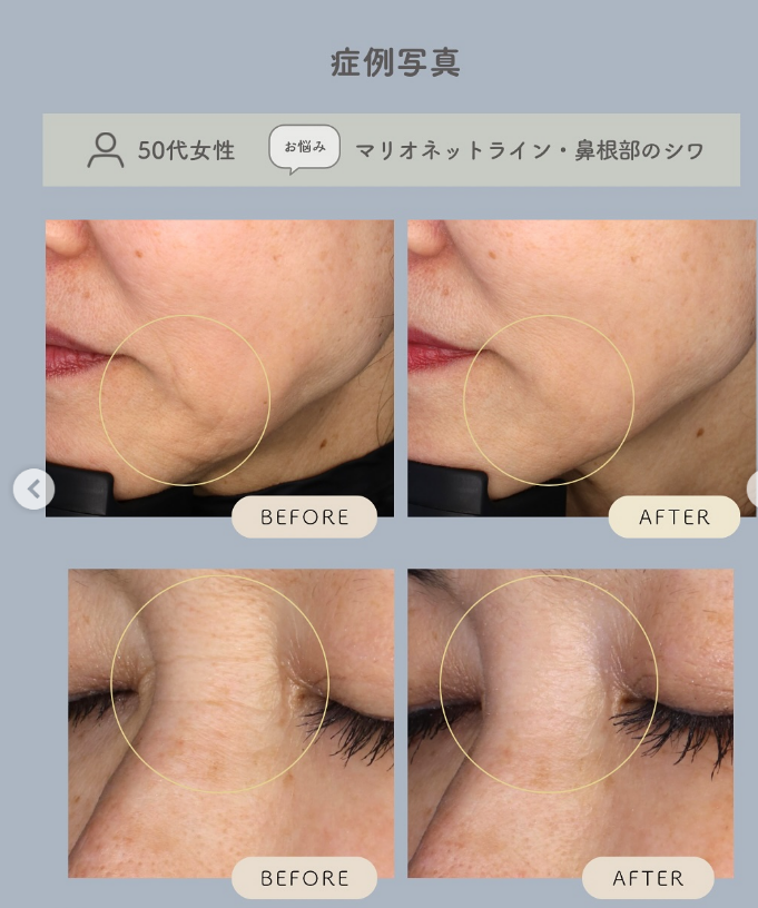 こりゃ凄い　CGスタイラー徹底解説！！